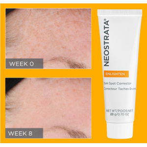 Neostrata Enlighten - Gel local pentru albire - Dark Spot Corrector 20gr